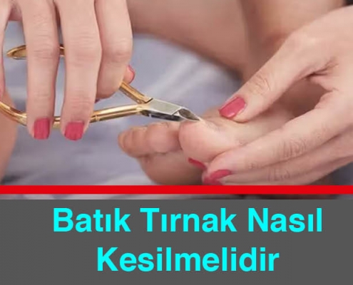 Podoterapi Batık Tırnak Nasıl Kesilmelidir