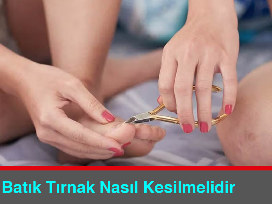 Batık Tırnak Nasıl Kesilmeli