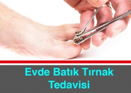 Evde Batık Tırnak Tedavisi Nasıl Yapılır