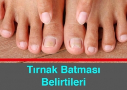 Tırnak Batması Belirtileri Nelerdir