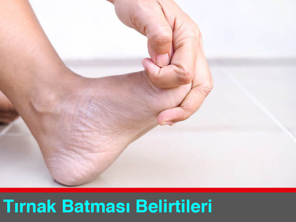 Batık Tırnak Nasıl Belirti Gösterir Podoterapi